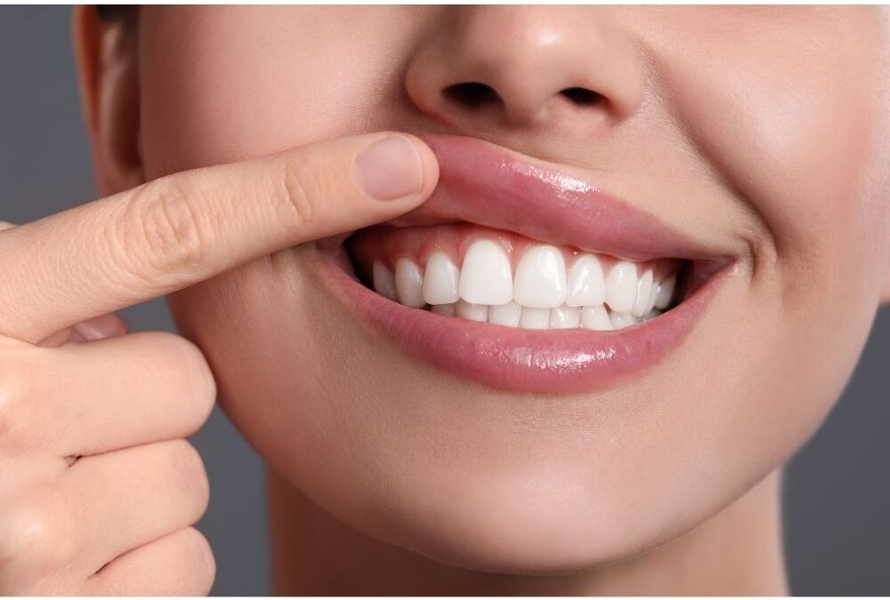 Η Υγεία των Μαλακών Ιστών Γύρω από τα Εμφυτεύματα